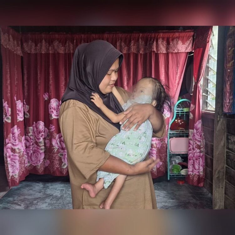 Farah, Bocah 4 Tahun Asal Nunukan Butuh Uluran Tangan