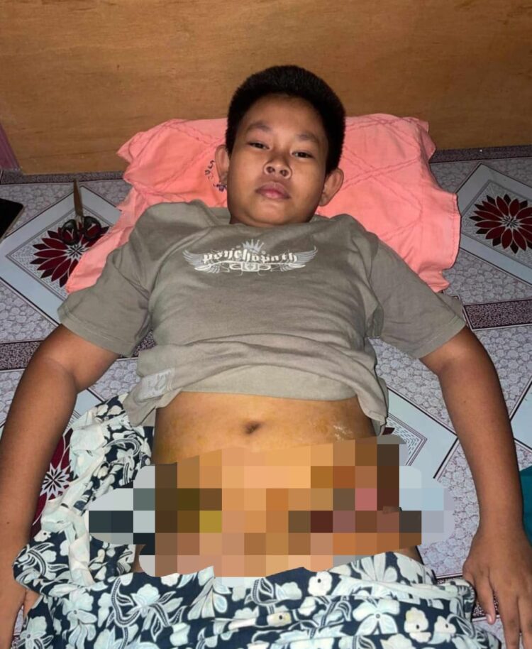 Namanya Ahkimie, Bocah Asal Nunukan yang Kini Melawan Kanker, Butuh Uluran Tangan Kita